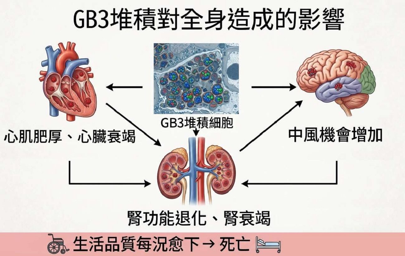 屏東首例法布瑞氏症確診　安泰醫院助病患年省500萬藥費