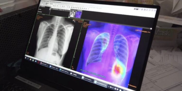 「科技入鄉 全人共享」  花東智慧醫療轉型與資源擴散