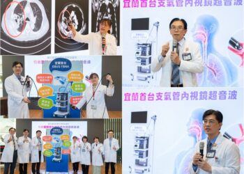 增添診斷肺癌新利器　陽明交大醫院引進支氣管內視鏡超音波