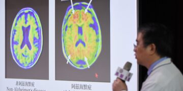 失智不害怕!整合照護 跨院合作 高醫推動「一院施打、四院服務」